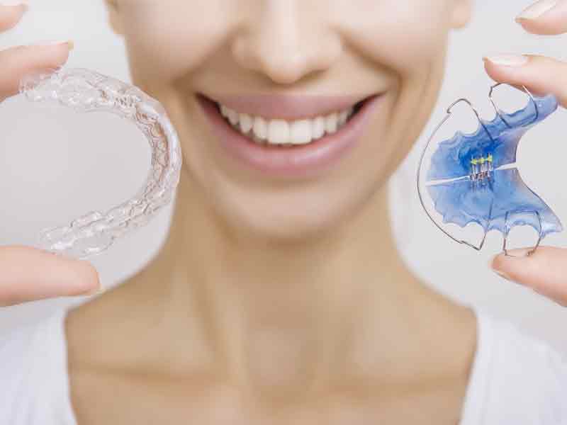 Woman holding clear and color retainers